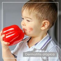 Dermatitis atópica