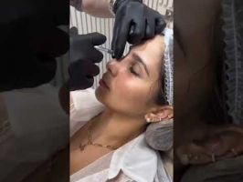 clinicas que eliminan tatuajes barranquilla Ivan Diazgranados Fernandez
