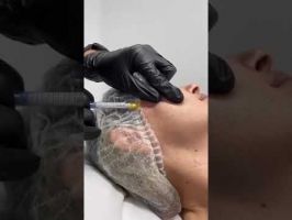 medicos dermatologia medico quirurgica venereologia barranquilla Ivan Diazgranados Fernandez