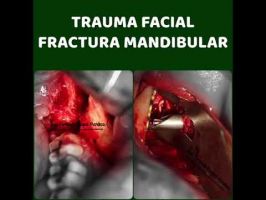 cirujanos maxilofaciales en barranquilla Dr. Jose Fernando Fragozo Mendoza, Cirujano maxilofacial