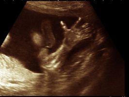 clinicas ecografias barranquilla Fetal Imagen. Dra. Amilde Quintero